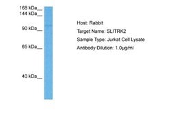 SLITRK2 Rabbit anti-Human, Polyclonal, Novus Biologicals 0.1 mL | Buy Online | Novus Biologicals | Fisher Scientific